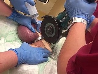 Clarification ne pas supprimer un Cock Ring!