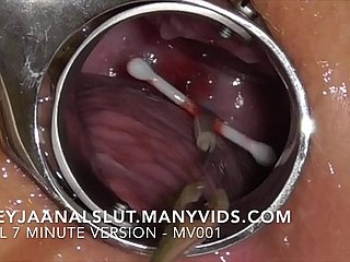 Am Nghiệp Freyjaanalslut: Loại bỏ IUD của mình - kéo nó ra khỏi cổ tử cung của Freyja, khiến cô ấy trở nên màu mỡ trở lại - phiên bản đầy đủ trên ManyVids