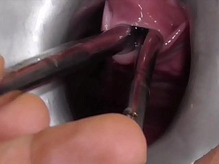 Unskilful FreyjaAnalslut:  Merging Sounds - James is distension Freyja's urethra with Merging sounds - peeing into Freyja's unbolted cunt