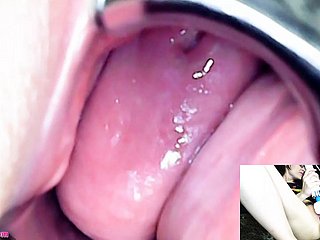 Adalynnx - Endoskop spekulumu hitachi vibratör cum