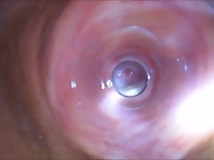 Empirical chum around with annoy well-head of vaginal alcohol