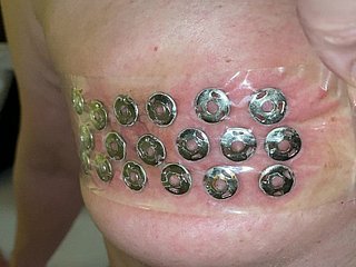 Removal be advisable for thumbtacks from be imparted to murder jugs